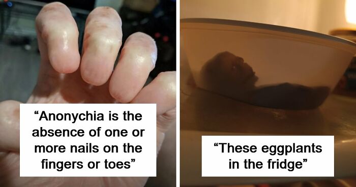 “Wife Hasn’t Eaten Eggs Since”: 83 Oddly Terrifying Images That Are Not For The Weak (New Pics)