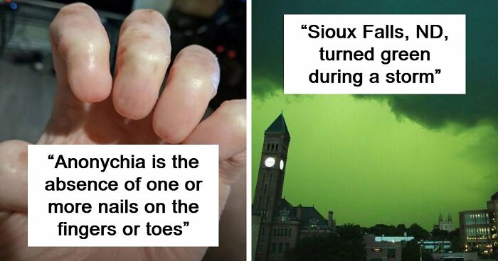 “Wife Hasn’t Eaten Eggs Since”: 83 Oddly Terrifying Images That Are Not For The Weak (New Pics)