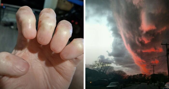 “Wife Hasn’t Eaten Eggs Since”: 83 Oddly Terrifying Images That Are Not For The Weak (New Pics)