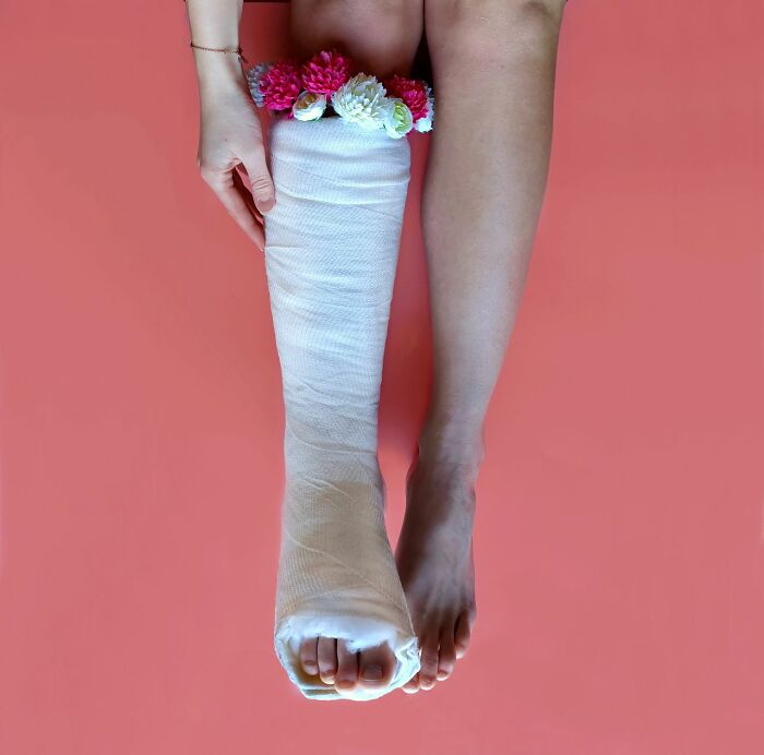 A person with a bandaged leg adorned with flowers, suggesting an unserious ER visit or recovery.