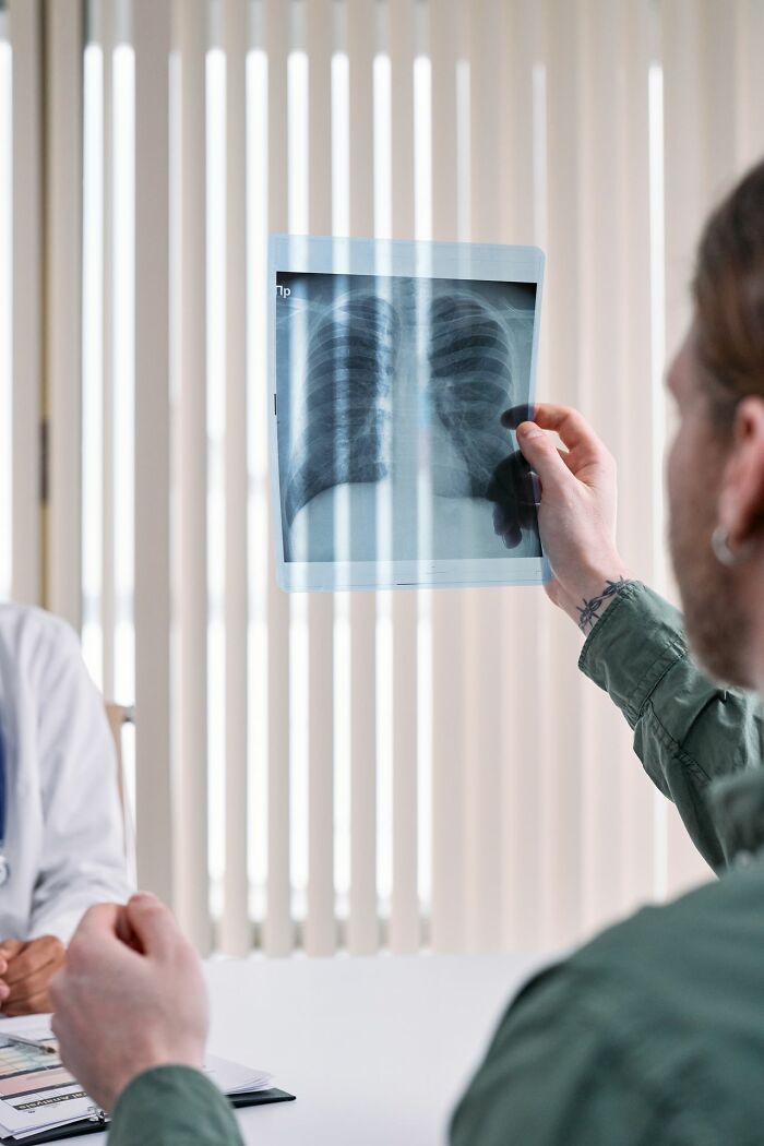 A man holds up an X-ray of his lungs in a doctor's office, perhaps for an unserious ER visit.