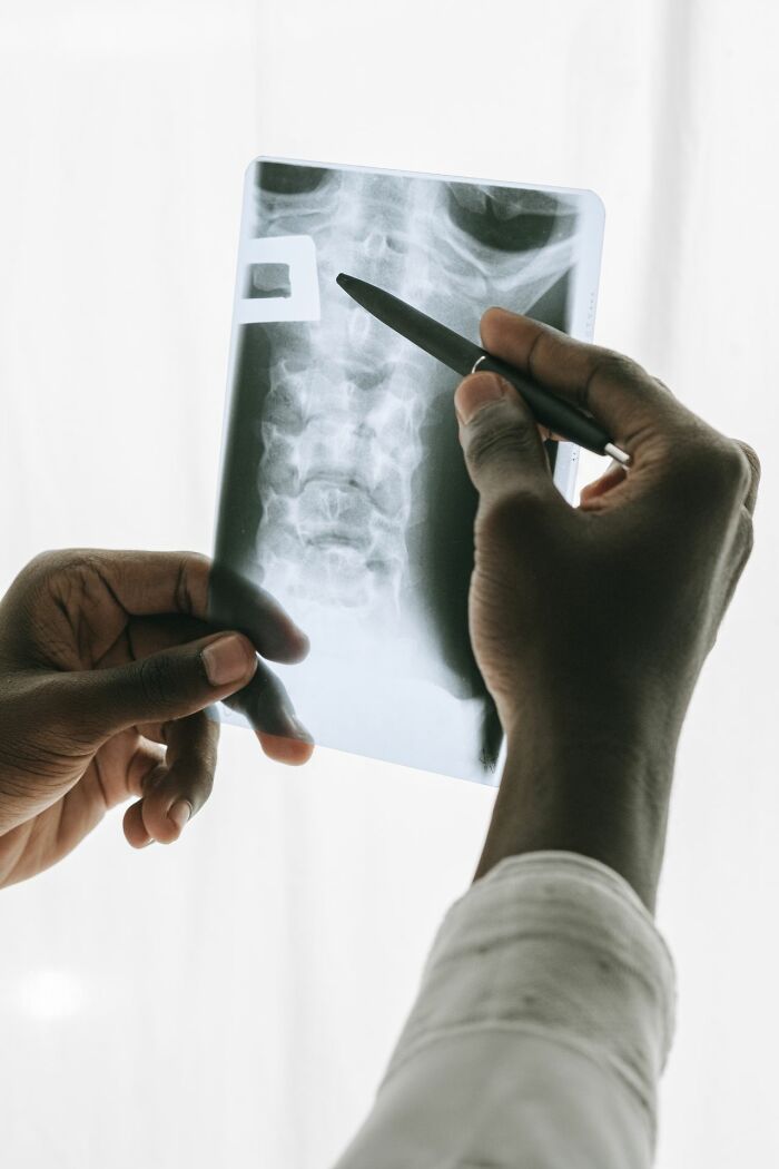 A doctor points to an X-ray of a spine, discussing types of pain patients won't comprehend.