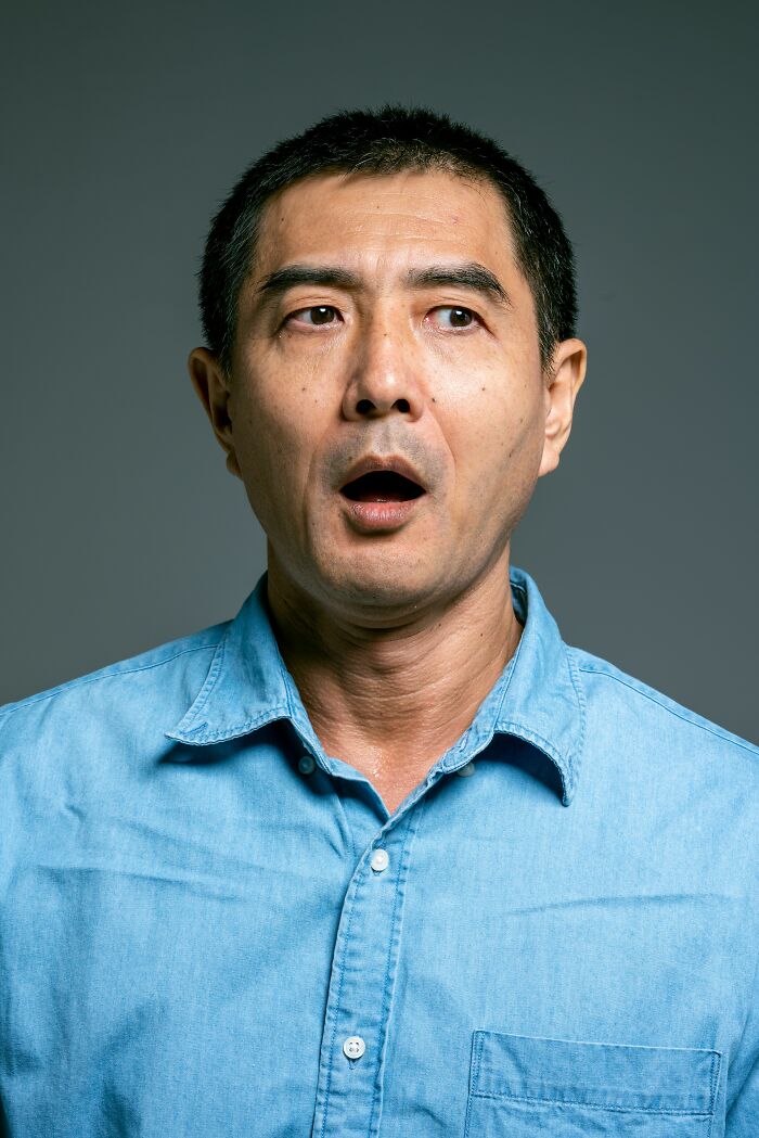 A man with an open mouth and wide eyes, appearing surprised or shocked, illustrating an unserious ER visit.
