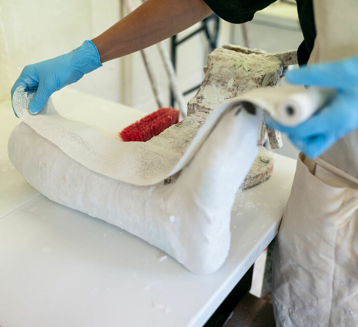 A doctor meticulously wraps a boy's leg in a plaster cast, preparing for the hidden surprise.