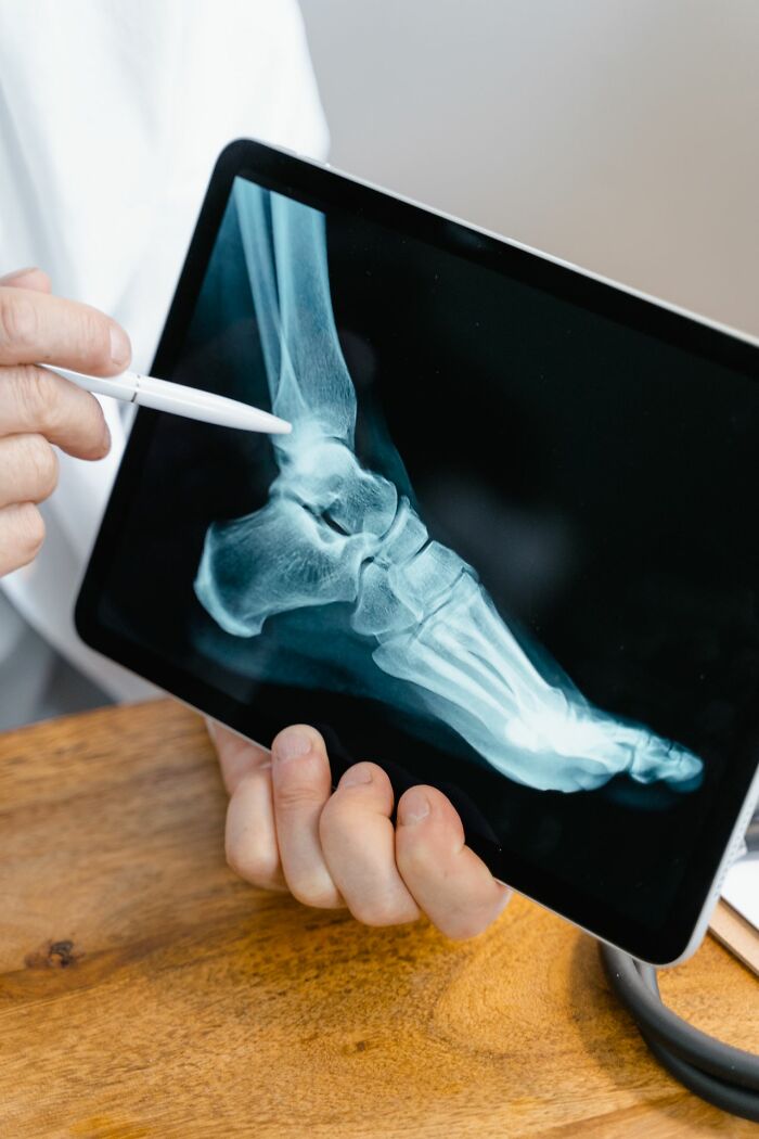 A doctor pointing at an X-ray of an ankle on a tablet, illustrating physical pain from injuries.