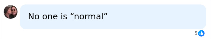 After Backlash On Down's Syndrome Pregnancy Termination, YouTuber Jesse Ridgeway States He's "Normal" After Backlash On Down's Syndrome Pregnancy Termination, YouTuber Jesse Ridgeway States He's "Normal"