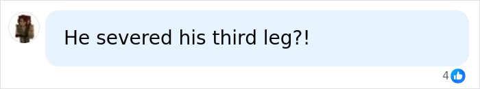 A social media comment with a shocking question about Joe Manganiello's amputation. A social media comment with a shocking question about Joe Manganiello's amputation.