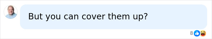 Screenshot of a comment on social media: But you can cover them up? Screenshot of a comment on social media: But you can cover them up?