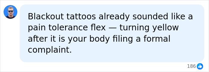 Machine Gun Kelly Reveals Frightening Side Effects Of Covering Body In Tattoo Ink, Doctors Unveil The Dangers Machine Gun Kelly Reveals Frightening Side Effects Of Covering Body In Tattoo Ink, Doctors Unveil The Dangers