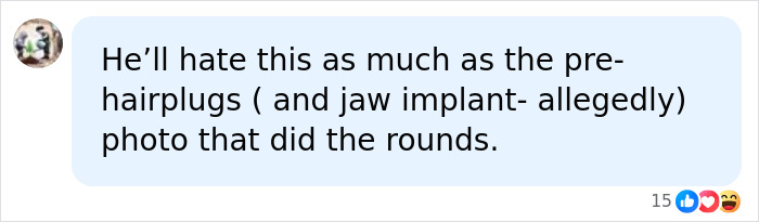 Social media comment referencing Elon Musk hairplugs and jaw implant rumors