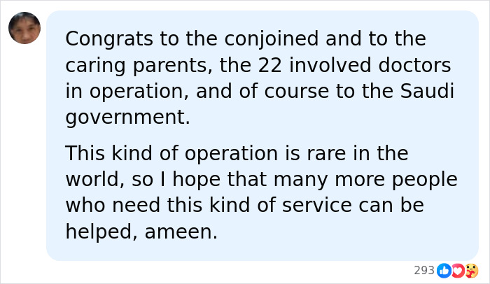 A social media comment congratulating all involved in the successful separation surgery of conjoined twins. A social media comment congratulating all involved in the successful separation surgery of conjoined twins.