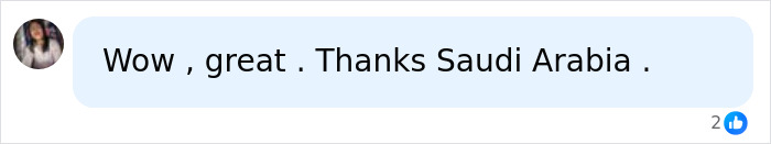 A social media comment praises Saudi Arabia after conjoined twins successfully separated. A social media comment praises Saudi Arabia after conjoined twins successfully separated.