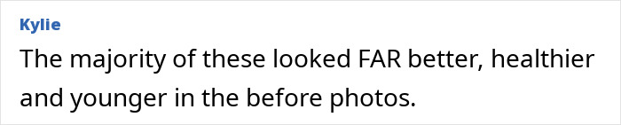 Comment on skeletonized look plastic surgery regrets about healthier before photos
