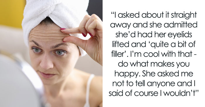 34YO Woman Gets Fillers And Botox, Asks Sis Not To Tell Anyone, She Does It Anyway Out Of Spite