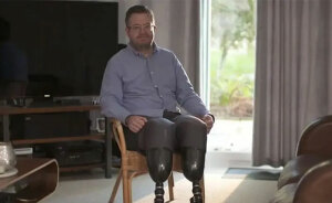 Professional Surgeon Thrown In Prison After Getting His Legs Amputated To Fulfill Intimate Desire And Lying