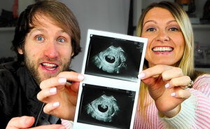 YouTuber Buried In Backlash After Revealing He And Wife Terminated Pregnancy Because Baby Had Down Syndrome