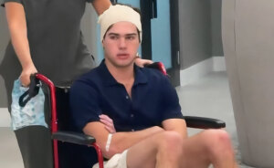 Looksmaxxer Clavicular Just Had His 3rd Surgery, And People Are Getting Concerned About His Transformation