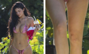 After Viral Post Claims Kylie Jenner's Knees Give Away Plastic Surgery, Surgeon Weighs In