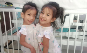 2-Year-Old Conjoined Twins Successfully Separated Following Grueling Six-Hour Surgery