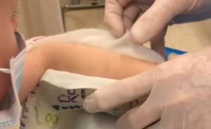 Doctor Discovers Jaw‑Dropping Surprise Hidden In Four‑Year‑Old Boy’s Plaster Cast