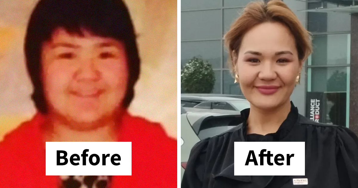 48 "Ugly Ducklings" Share The Incredible Transformations That Made Them Love Themselves | Bored Panda