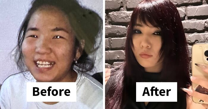 48 “Ugly Ducklings” Share The Incredible Transformations That Made Them Love Themselves