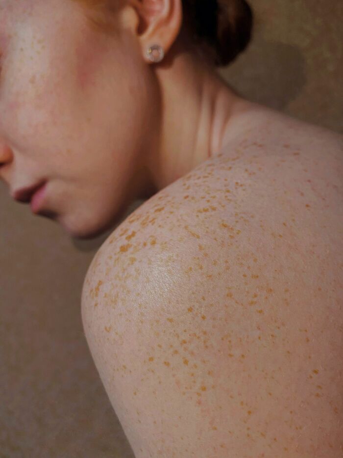 Close-up of a human body with freckles on the shoulder, illustrating facts about human bodies.
