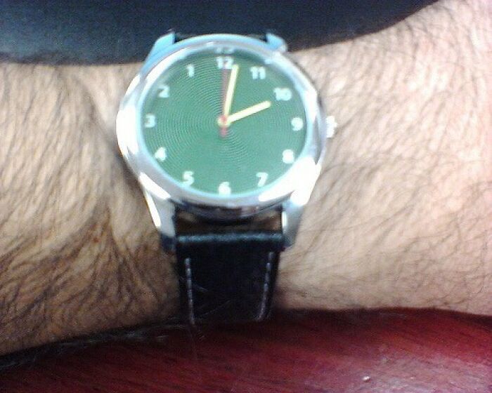 A close-up of a wrist wearing a green-faced watch. When You See It, the arm hair is quite prominent.
