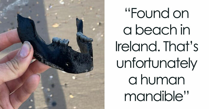 “WHY WOULD YOU TOUCH THAT?!”: 71 Things That Should Really Be Left Alone
