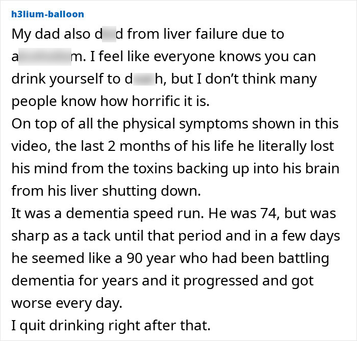 "Your Sign To Stop Now": Woman's Story Stuns As She Shares Experience With Liver Failure Due To Drinking