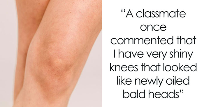 “Still Not Sure If That Was A Dig Or A Compliment”: 56 Unhinged Comments Women Received About Their Bodies