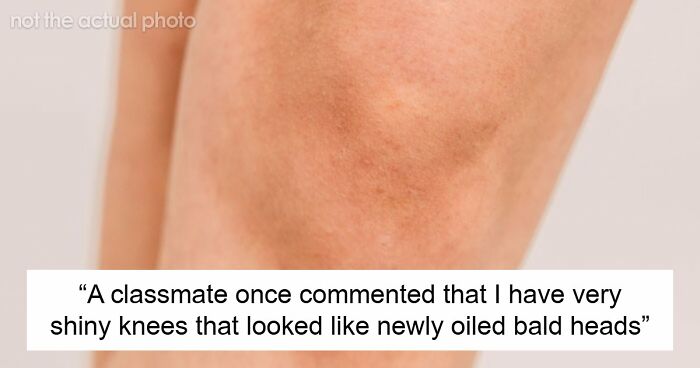 “Still Not Sure If That Was A Dig Or A Compliment”: 56 Unhinged Comments Women Received About Their Bodies