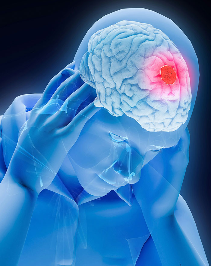 A 3D rendering of a human brain with a red, glowing area indicating suspected brain cancer, representing a horror story.