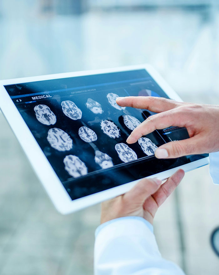 A medical professional reviews brain cancer scans on a tablet, suspecting a horror story.