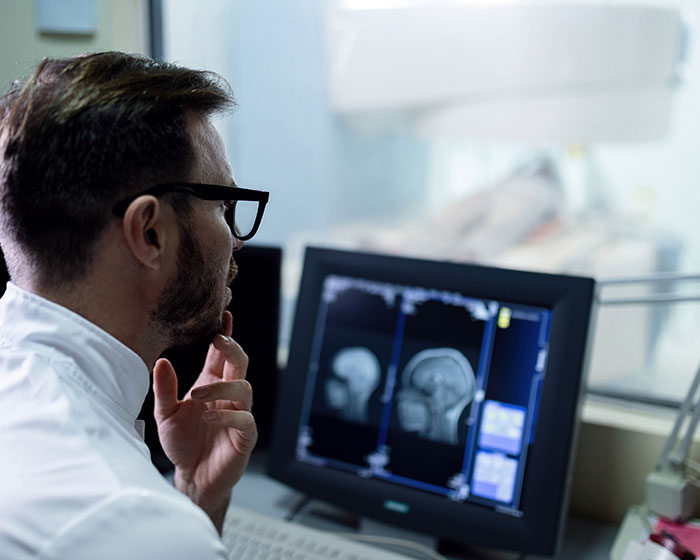A doctor examining brain scans on a computer, exploring factors leading to dementia.