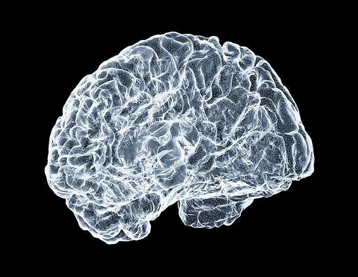 Adult star's mom gives heartbreaking health update after devastating tragedy left her permanently disabled. Brain scan imagery. Adult star's mom gives heartbreaking health update after devastating tragedy left her permanently disabled. Brain scan imagery.