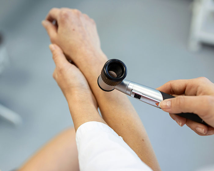 Dermatologist examining a patient's arm with a dermatoscope for a skin red flag and heart problems. Dermatologist examining a patient's arm with a dermatoscope for a skin red flag and heart problems.