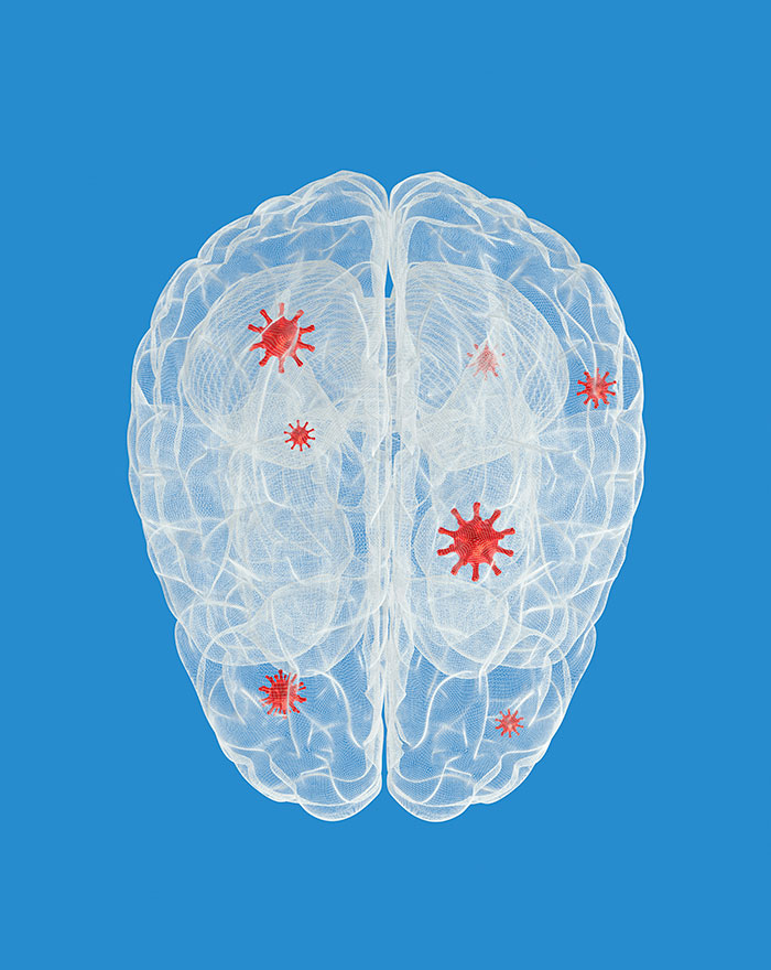 Illustration of a brain with red, star-shaped elements representing a medical horror story inside, not brain cancer.