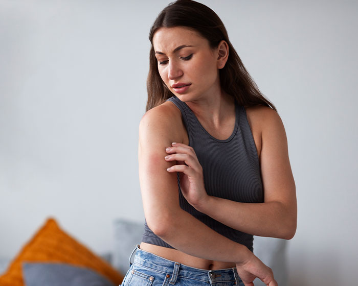 Woman scratching an itchy red rash on her arm, a potential skin red flag signaling heart problems. Woman scratching an itchy red rash on her arm, a potential skin red flag signaling heart problems.