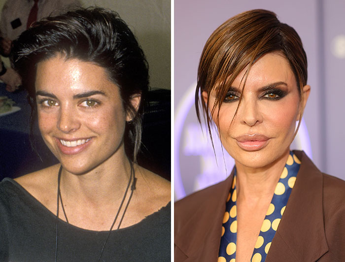 Lisa Rinna before and after plastic surgery, illustrating a change from her natural appearance to a more augmented one.