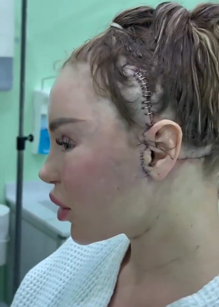Woman’s Post-Plastic Surgery Photos Divide The Internet As She And Her Surgeon Celebrate The Results