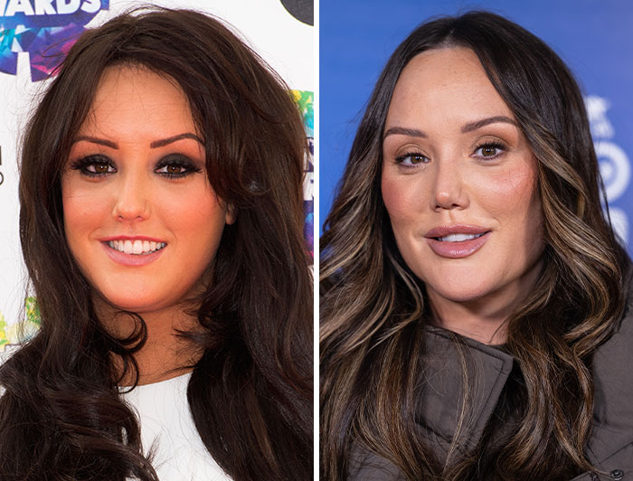 Charlotte Crosby pre-plastic surgery on the left and her post-surgery image on the right, revealing celebrity enhancements.