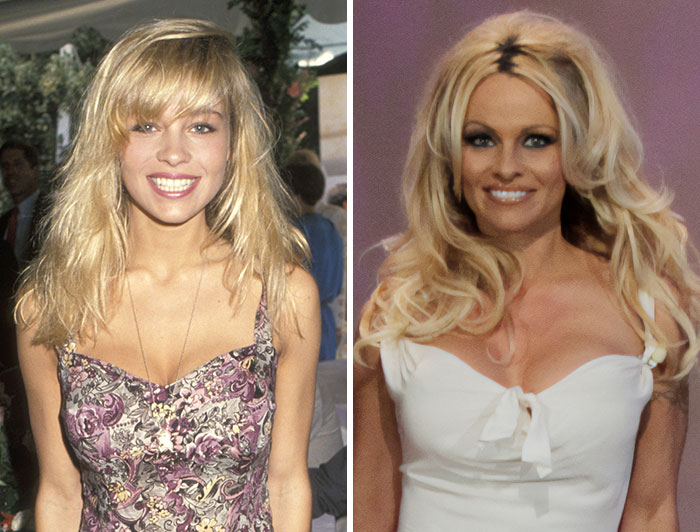 Pamela Anderson before and after plastic surgery showing a transformation from natural blonde to a more stylized look.
