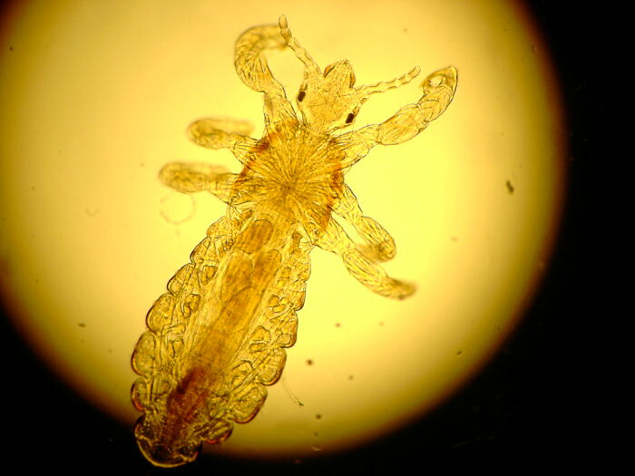 A magnified view of a human body louse, a disturbing fact showing parasites up close.