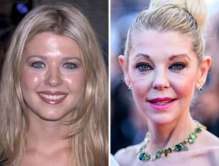 Tara Reid pre-plastic surgery and post-plastic surgery comparison photos of celebrities.