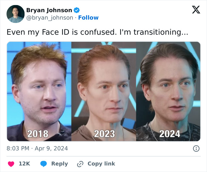A tweet from Bryan Johnson showcasing his facial changes from 2018 to 2024, emphasizing his biohacker transformation. A tweet from Bryan Johnson showcasing his facial changes from 2018 to 2024, emphasizing his biohacker transformation.