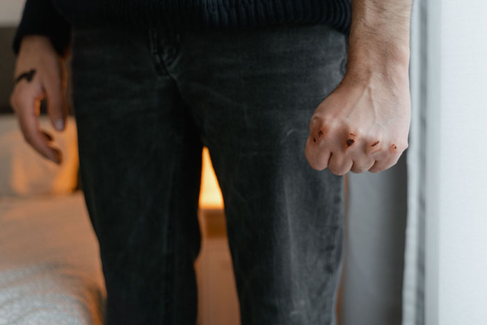 47 People Who Survived The Craziest And Most Terrifying Moments Of Their Lives