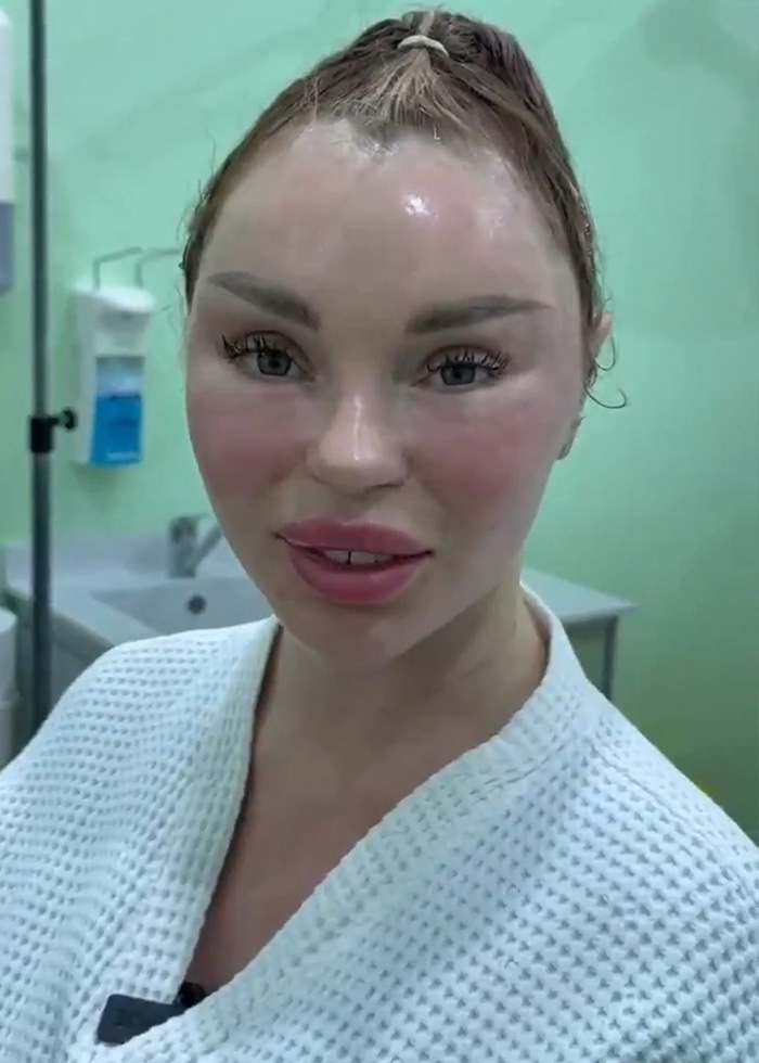 Woman’s Post-Plastic Surgery Photos Divide The Internet As She And Her Surgeon Celebrate The Results