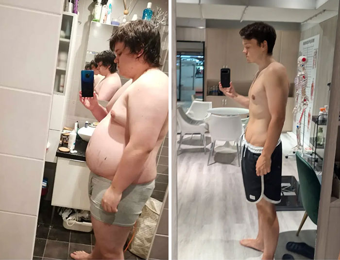 Before-and-after photos of a man who attended a Chinese fat camp, showing significant weight loss. Before-and-after photos of a man who attended a Chinese fat camp, showing significant weight loss.
