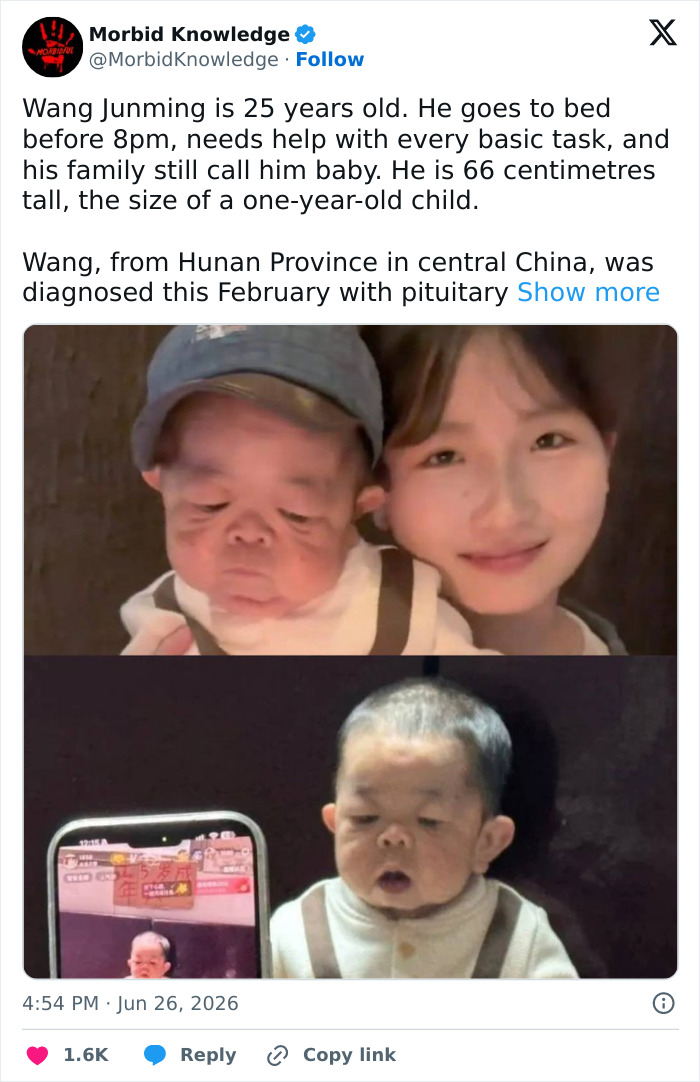 W**g Junming, a 25-year-old appearing as a baby, part of morbid and sad stories, one of the worst days of life.